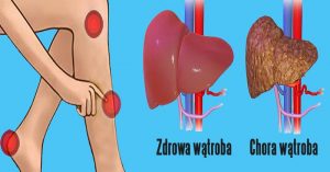 produkty dla zdrowia wątroby